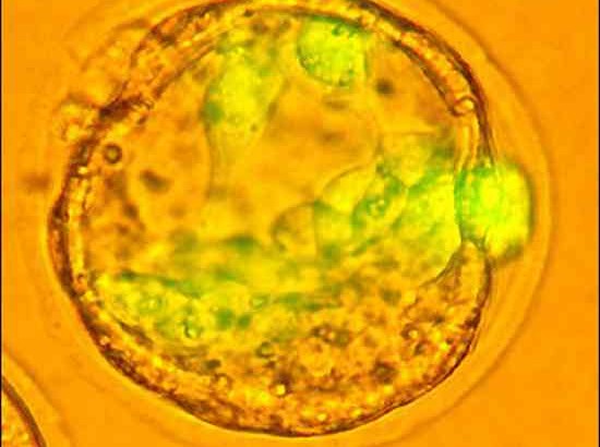 Taip per mikroskopą atrodo embriono kilmės kamieninė ląstelė. humansfuture.org nuotr.