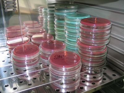Petri lėkštelėje ant mitybinės terpės paviršiaus auginamos bakterijų kultūros. sxc. hu nuotr.